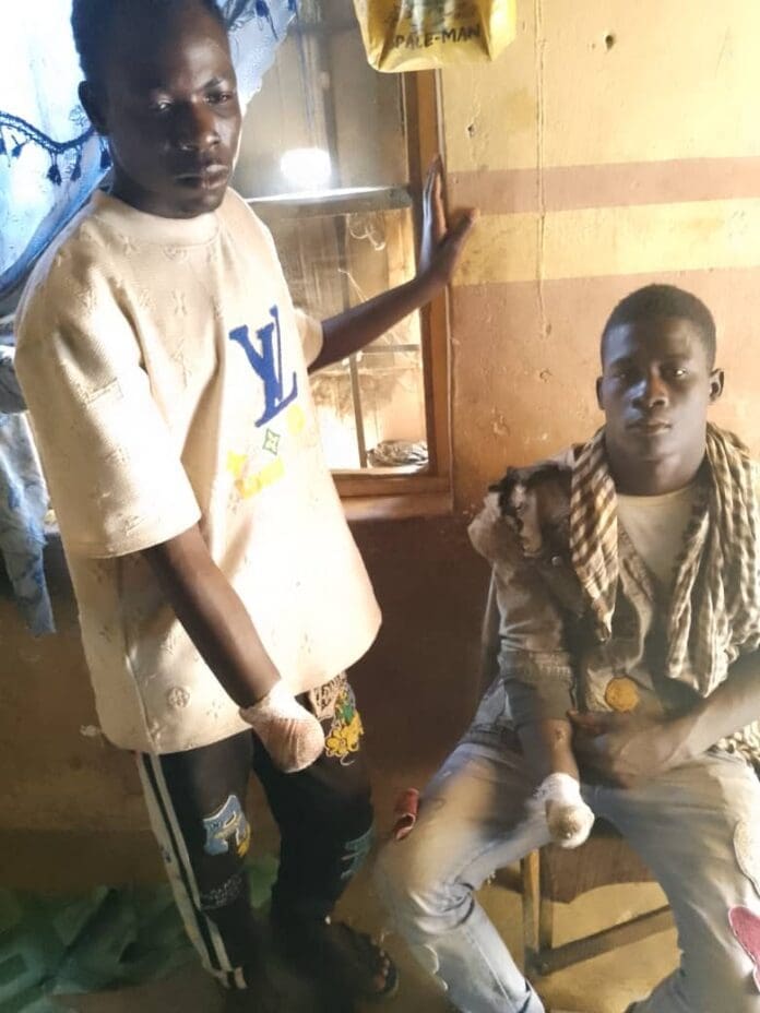 Two fishermen with amputated hands by terrorist militia. Photo credit: X/@ZagazOlaMakama.