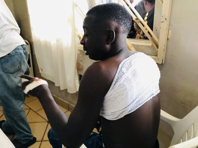 A bullet pierced Shalom Enoch’s chest through to his back after he attempted to help his friend Kadish before he gave up. Credit Masara Kim