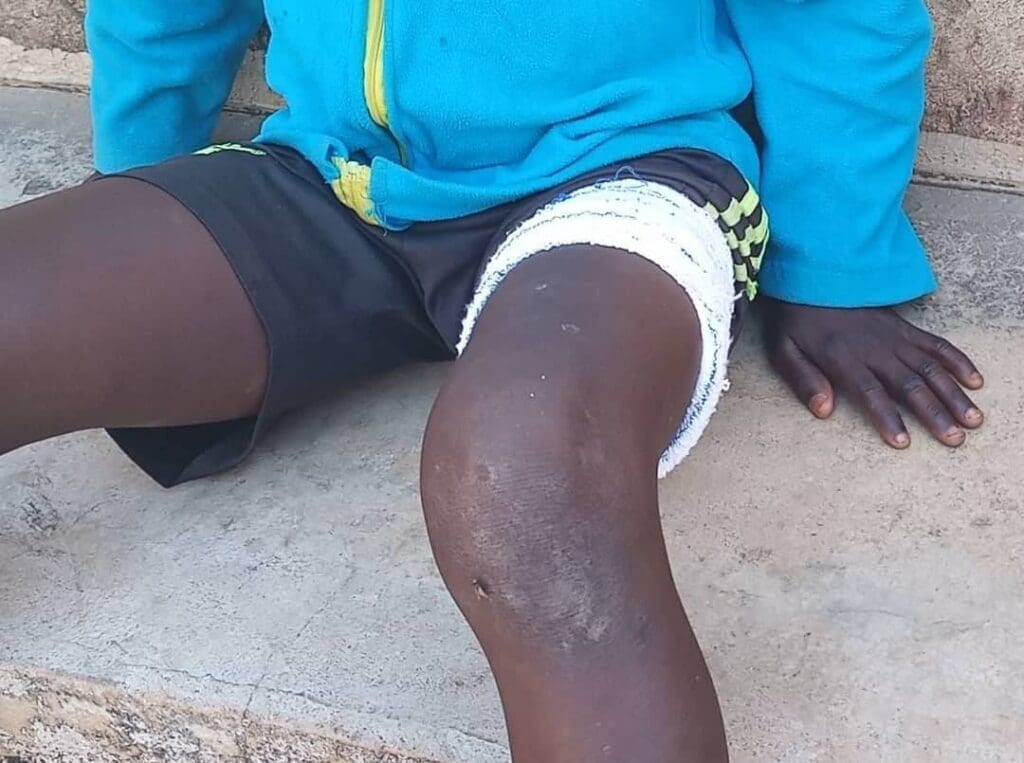 Dennis Luka, 10, was shot in the leg. Credit: Mike Odeh James