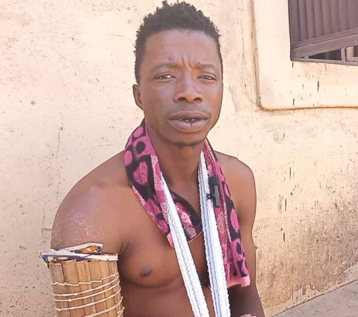 Markus Maaji, a wounded resident of Agamah. Credit: Mike Odeh James.