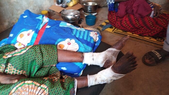 Injured victim of the camp following rescue. Photo by Mike Odeh James.
