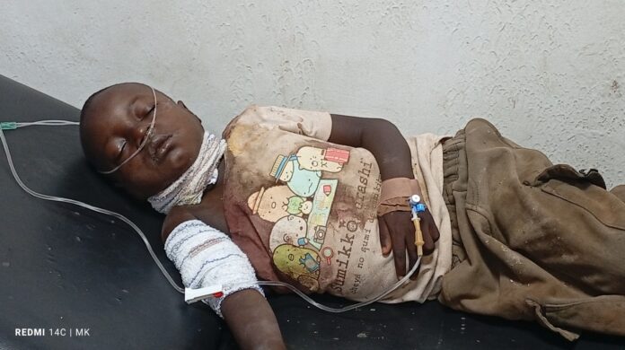 Child gets treated in Jos hospital following Fulani Militia massacres in Kwall and Bokkos counties of Plateau State. Credit: Masara Kim.