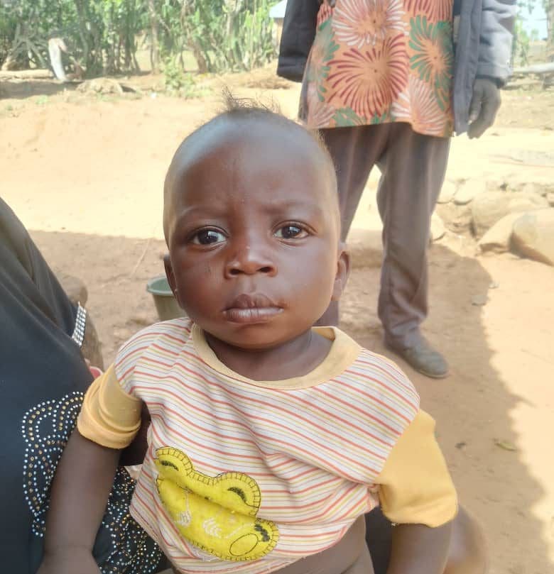 Dalo with injuries after the attack. Photo by Steven Kefas.