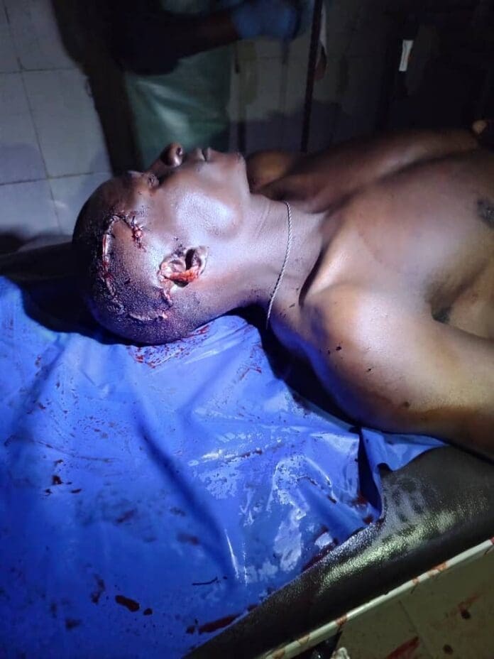 Victims of military shooting in Gyambwas on June 9 receiving treatment in hospital. Credit Plangji Gumwesh.