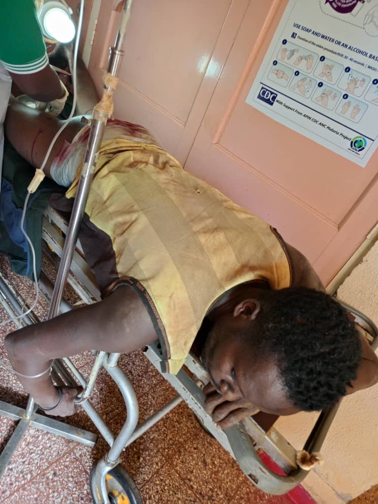 Victims of military shooting in Gyambwas on June 9 receiving treatment in hospital. Credit Plangji Gumwesh.