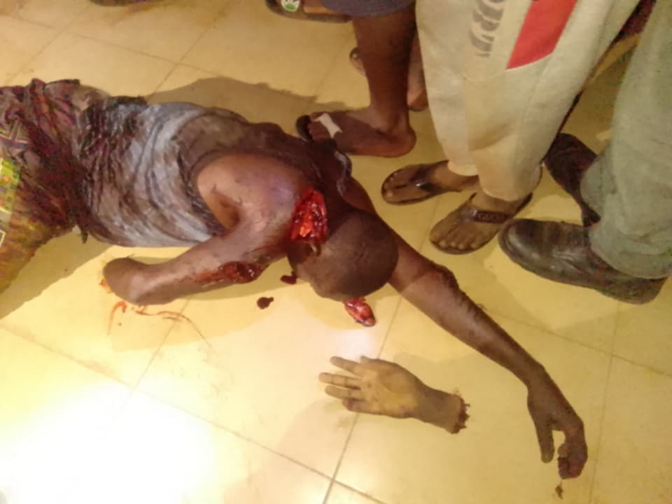 Victims of Naka attack on Sunday. Photo by Ekani Olikita.