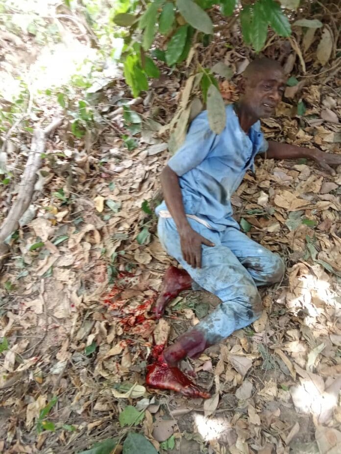 Antenyi After being shot by Fulani terrorists 