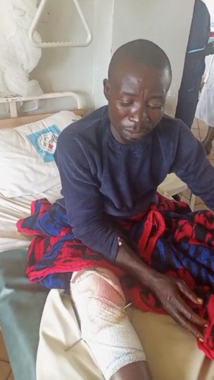 Mr. Kasuwa Paje, a civilian guard injured in Margif, Mushere on August 5th. Credit Kopmut Monday Shadrach. 