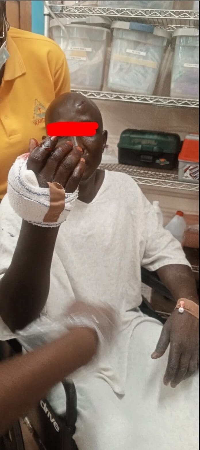 Mr Sunday Ajawe, Christian Farmer slashed by Fulani Ethnic Militia terrorists in Egbe, Kogi state. Picture Courtesy: Iselaiye Ezra.