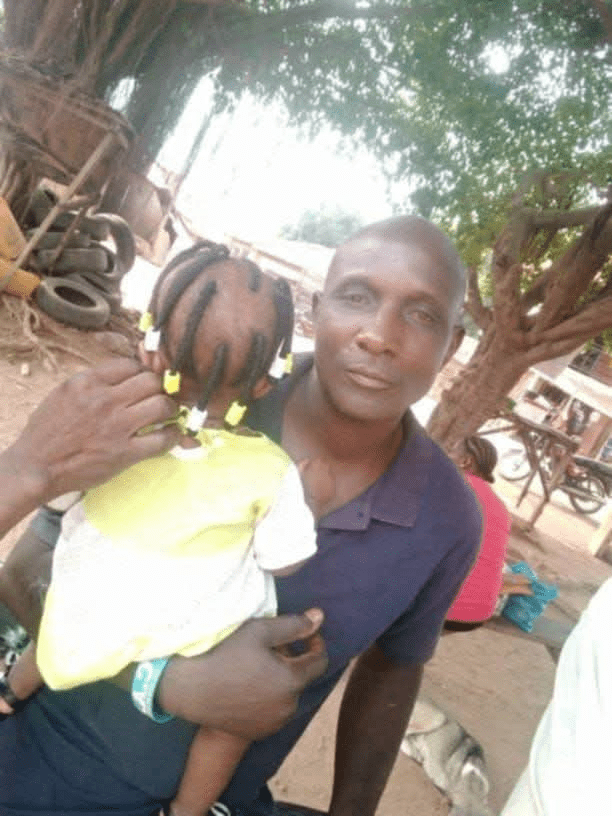 Mr Sunday Ajawe, Christian Farmer slashed by Fulani Ethnic Militia terrorists in Egbe, Kogi state. Picture Courtesy: Iselaiye Ezra.