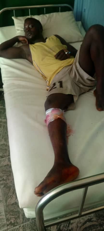 Joshua Kure, 23, one of the volunteer guards at Wakeh nursing a gunshot injury at Alheri Hospital, Kachia, Monday 8th September, 2024 (Credit: Mike Odeh)
