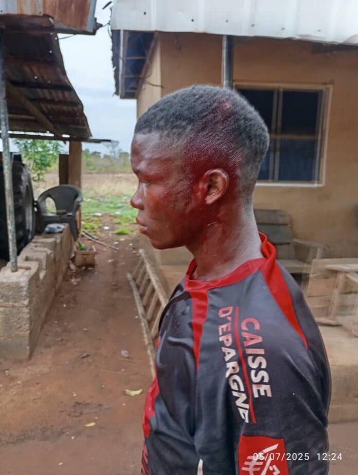 A survivor of Amadu Attacks. Credit Mike Odeh James.