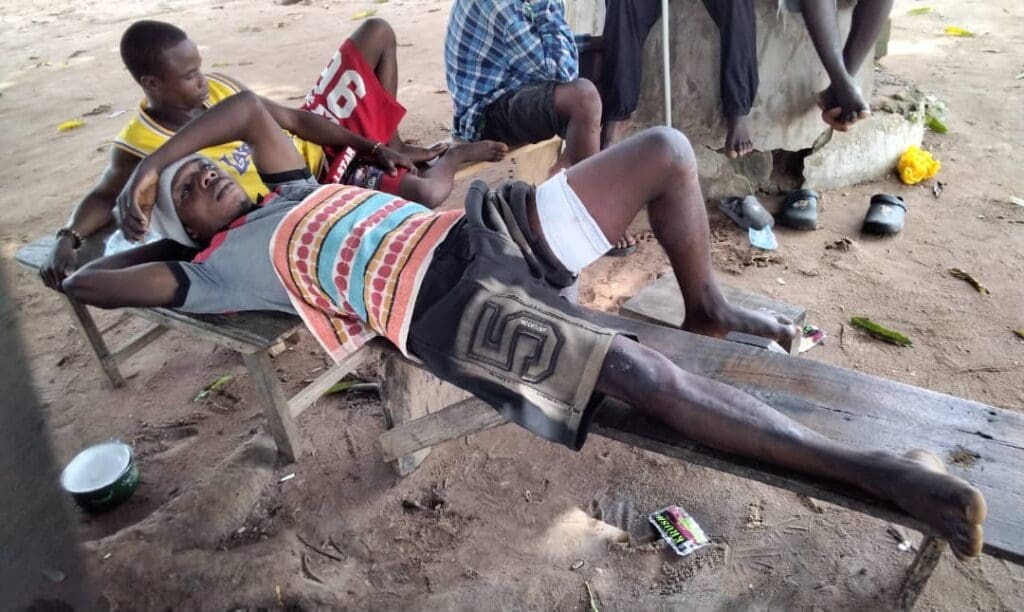 A survivor of Amadu Attacks. Credit Mike Odeh James.