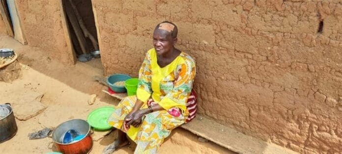 Elderly victim of Sunday morning attack on Kurmin Wali Village. Woman was wounded on scalp by Fulani ethnic militia. Credit: Mike Odeh James.