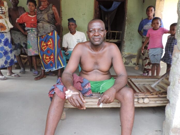 Terwua Hirekaan a farmer in his early 50s was ambushed and wounded by terrorists while gathering food. Photo by Izhi Bitrus Adamu.