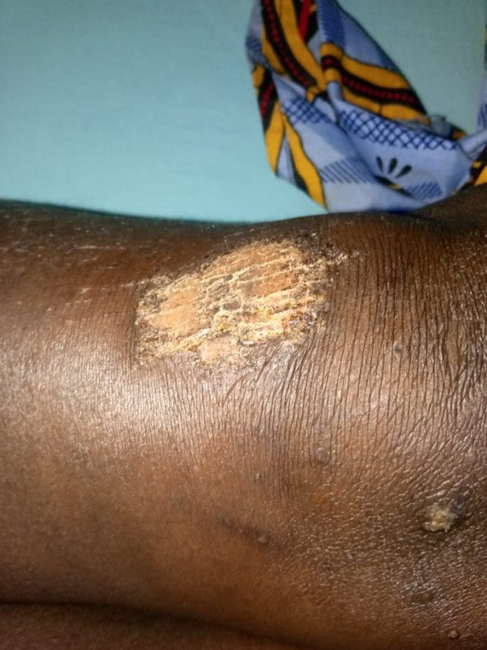Female Victim of Rijana Forest secured by Equipping The Persecuted. Credit ETP