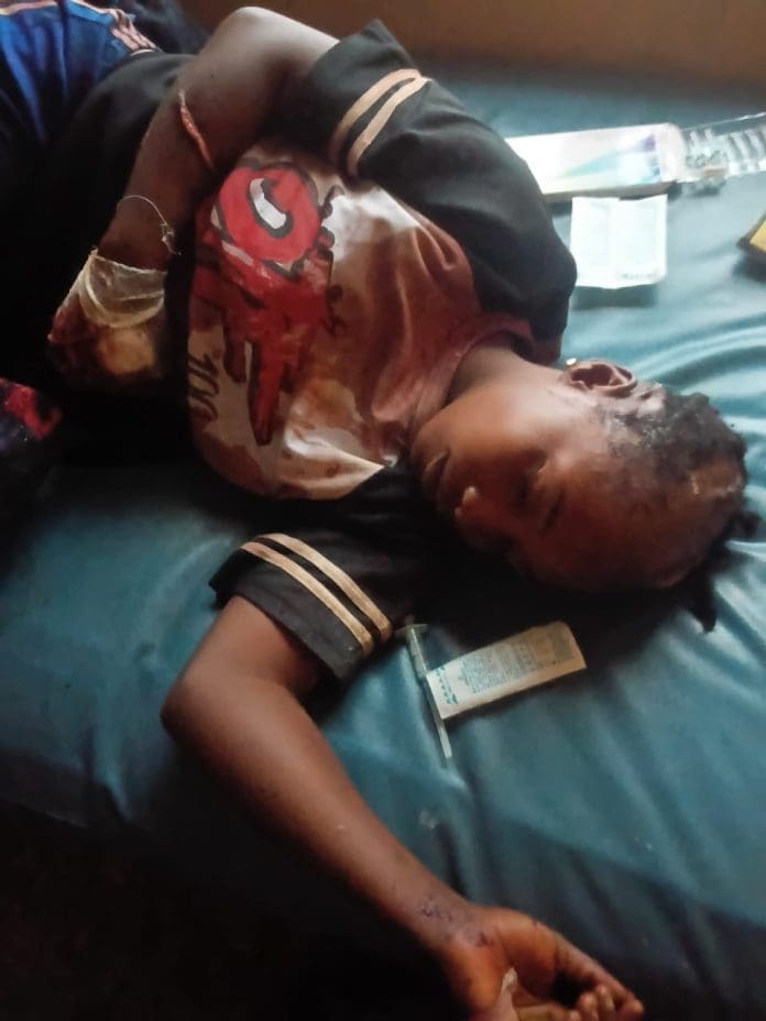 Asabe Victor, 26, sustained life-threatening injuries during Tuesday (June 17, 2026) night invasion of Unguwan Magaji village, Kauru county, Southern Kaduna, by Fulani Ethnic Millitia, receiving treatment at a medical facility in Zangon Kataf, General Hospital, Southern Kaduna on Wednesday June 17, 2026 (Credit: Facebook)