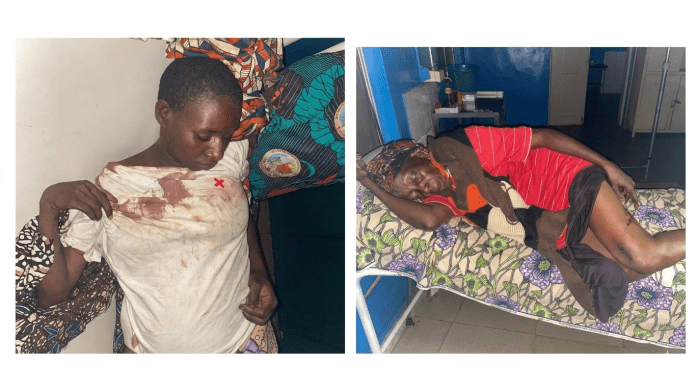Victims of Fulani Ethnic Militia attack in Zangon Kataf, Kaduna State. Photo credit: Zagazola Makama. 